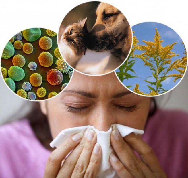 kak-poborot-allergiyu-e1578039406598 Как побороть аллергию - 4 правила в жизни аллергиков